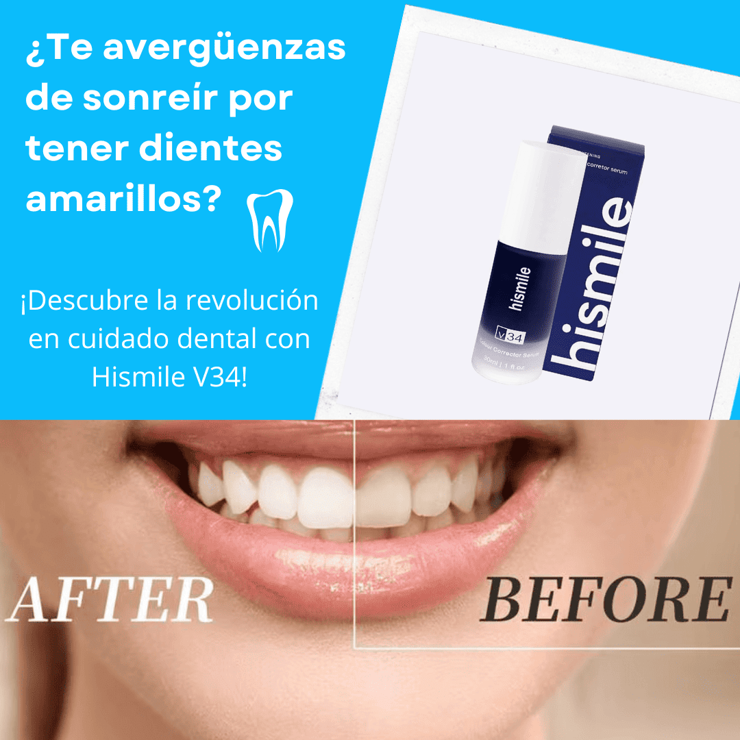 🔥 Hismile V34 - La Solución Definitiva Para Una Sonrisa Radiante 🔥