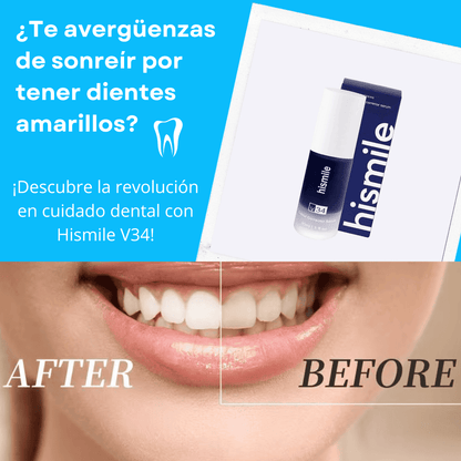 🔥 Hismile V34 - La Solución Definitiva Para Una Sonrisa Radiante 🔥